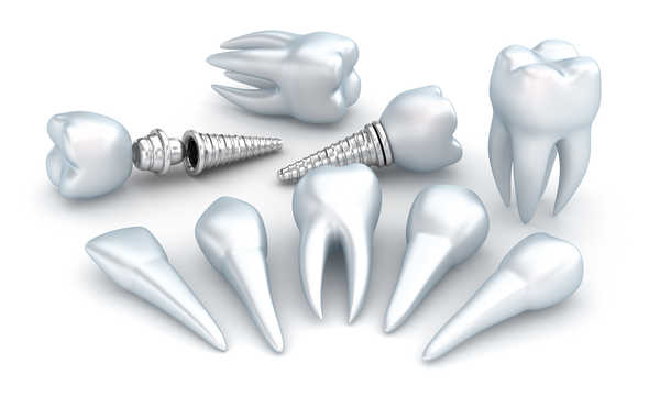 Dostępność darmowych implantów zębowych na NFZ