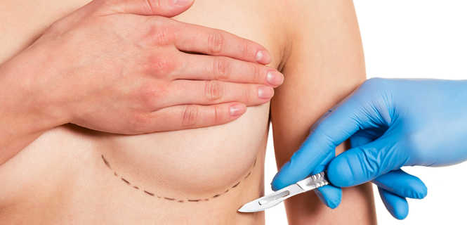 Miejsce wprowadzenia implantu piersiowego - od czego zależy?