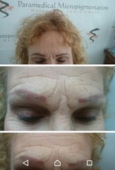 Mikropigmentacja naprawcza - naprawa źle wykonanego makijażu / kamuflażu przed i po zabiegu