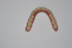 Proteza zębowa Lokator przed i po zabiegu