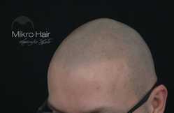 Mikropigmentacja - zagęszczenie naturalnych włosów przed i po zabiegu