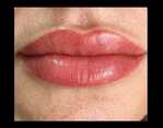 Makijaż permanentny ust z wypełnieniem przed i po zabiegu