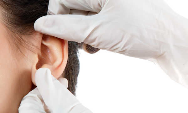 Czy operacja odstających uszu może być refundowana przez NFZ