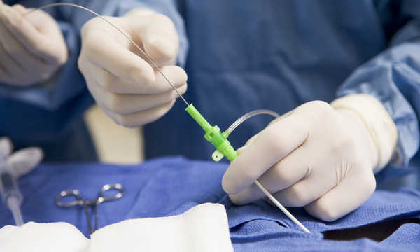 Co to jest cholecystektomia laparoskopowa?