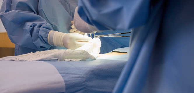 Operacja przepukliny brzusznej z użyciem siatki