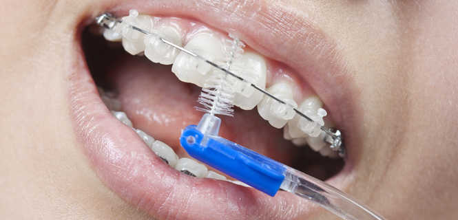 Wizyty kontrolne w trakcie leczenia ortodontycznego