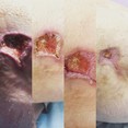 Opracowanie rany przed i po zabiegu